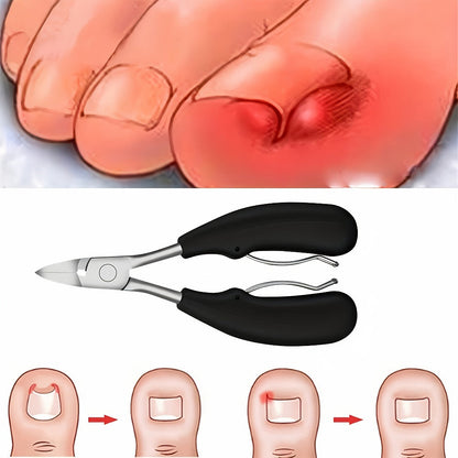 Large Opening Diagonal Blade Toenail Clippers for Thick Nails 5-Piece Set Heavy Duty Stainless Steel Ingrown Toenail Clipper with Nail File for Seniors Men Women Big Toe Cutter Kit