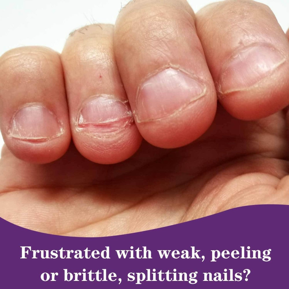Base Coat and Top Coat 2-in-1 Nail Polish Super Strong Chip Resistant Long Lasting High Shine Nourishing Nail Treatment Stops Chipping and Peeling for Healthy Beautiful Nails 10ml