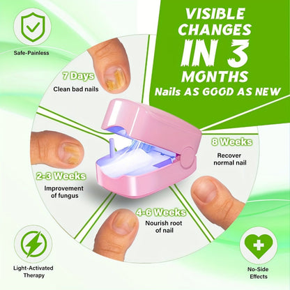 Nail Fungus Laser Treatment Device – FDA Cleared Anti-Fungal Laser for Toenail & Fingernail Fungal Infections, 7-Minute Home Treatment