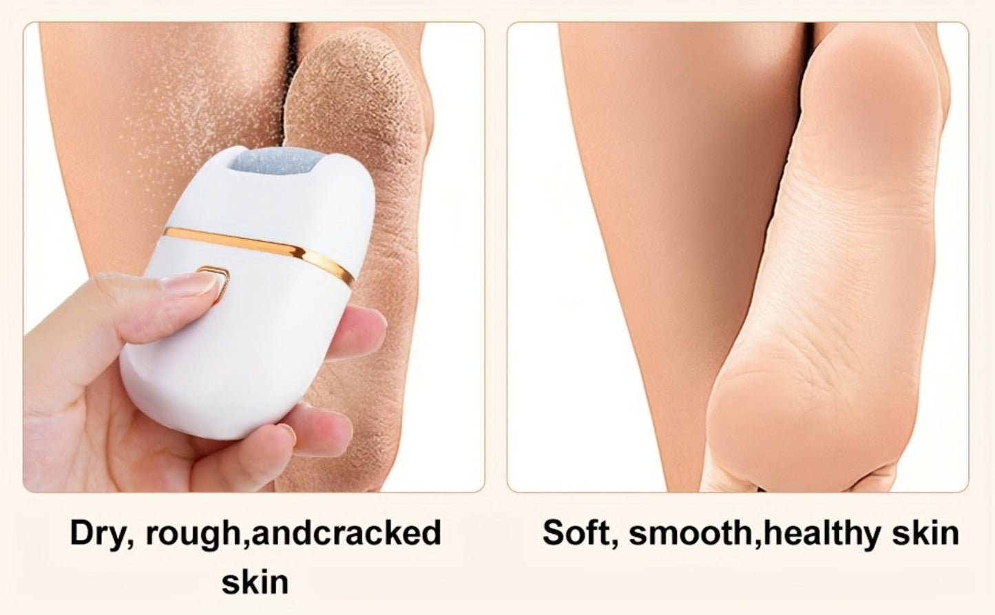 Electric Callus Remover Rechargeable Foot Grinder with 3 Replacement Heads 2 Speed Settings IPX5 Waterproof USB Charging Portable Pedicure Tool for Cracked Heels Dead Skin Women Men