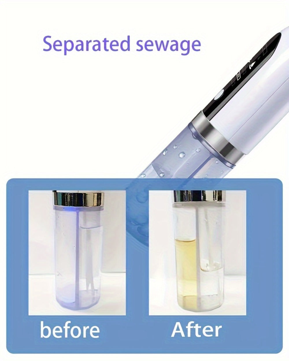 Pore Vacuum Blackhead Remover – 6 Interchangeable Heads & 3 Suction Levels, USB Rechargeable Electric Pore Cleaner, Visible Deep Cleansing Facial Extractor for Men & Women, All Skin Types
