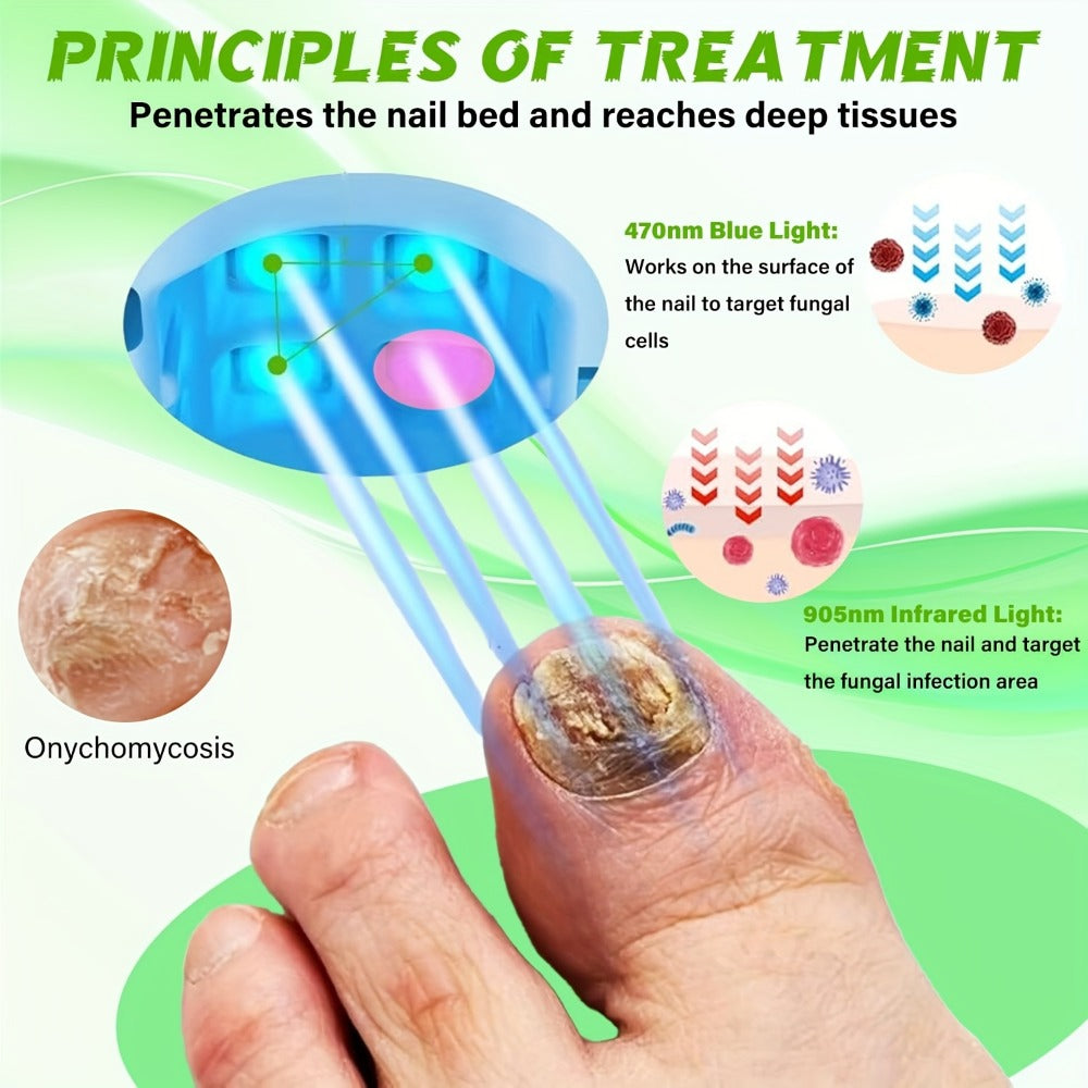 Nail Fungus Laser Treatment Device – FDA Cleared Anti-Fungal Laser for Toenail & Fingernail Fungal Infections, 7-Minute Home Treatment