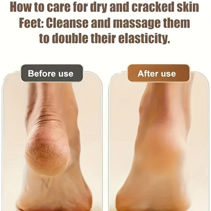 Electric Callus Remover Rechargeable Foot Grinder with 3 Replacement Heads 2 Speed Settings IPX5 Waterproof USB Charging Portable Pedicure Tool for Cracked Heels Dead Skin Women Men