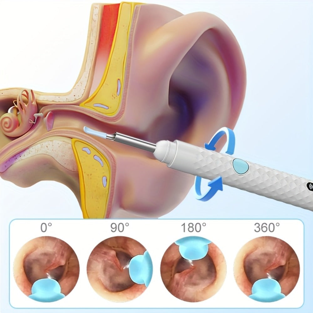 Ear Cleaning Camera Kit 1080P HD Rechargeable Lithium Battery – 6 Ear Spoons, Ear Tweezers, Visual Ear Wax Removal Tool Compatible with All Smartphones for Adults Safe Home Ear Care