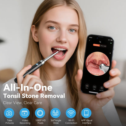 Intelligent Visual Tonsil Stone Removal Kit – 1080P HD Camera, 6 LED Lights, Wi-Fi & App Connection, Multi-Accessory Oral Inspection Tool for All Ages