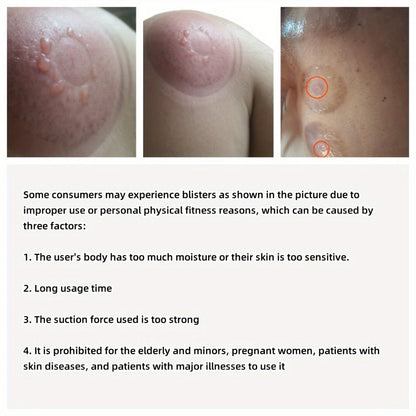 Electric Cupping Massage Device with Remote Control – Neck Back Waist Shoulder Massager, 3 Modes, Hot Compress Therapy, Deep Tissue Relief