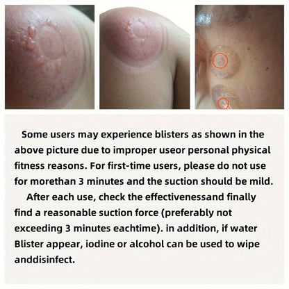 Electric Cupping Massage Device with Remote Control – Neck Back Waist Shoulder Massager, 3 Modes, Hot Compress Therapy, Deep Tissue Relief