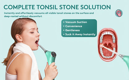 Tonsil Stone Remover Electric Vacuum Kit – Built-In LED Light, 3 Suction Modes & 5X Magnifying Mirror, Oral Irrigator for Safe Effective Tonsil Stone Removal at Home