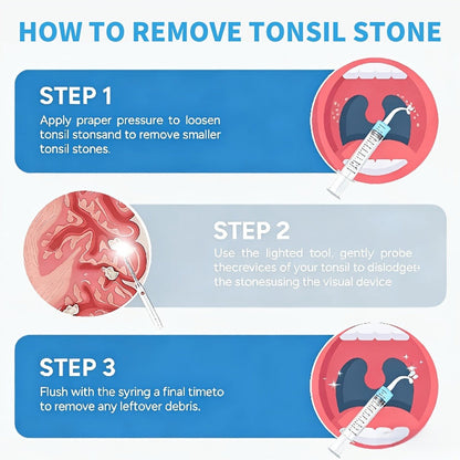 Tonsil Stone Remover with Camera 1080P HD Visual Oral Care Kit - 6 LED Lights, 5 Stainless Steel Tips, Wi-Fi App Control, USB-C Rechargeable Bad Breath Treatment Tool for iOS & Android