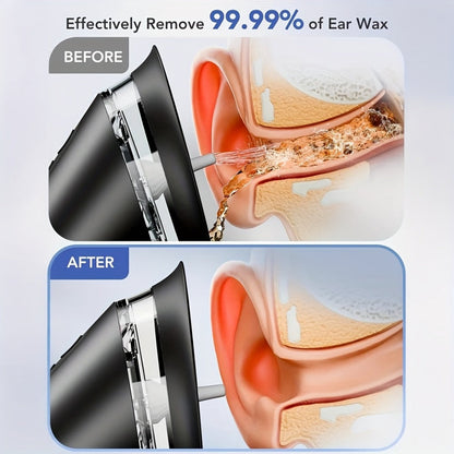 Ear Wax Removal Kit Electric Hydraulic Pro – 3-Speed Water Flushing Ear Cleaner with Temp Sensor, Visual Waste Tank, USB Rechargeable, Nozzle Belt, Medical-Grade Safe Home Ear Care System