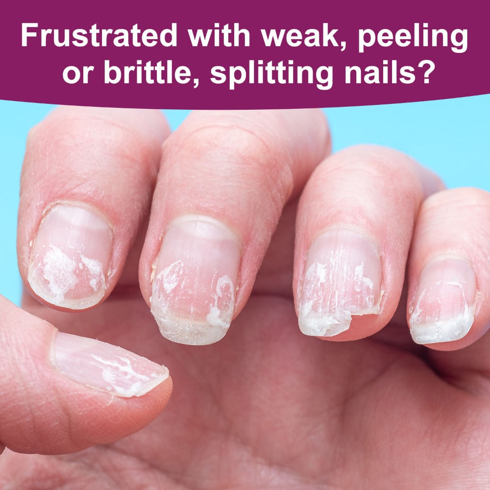 Nail Fortifier & Hardener 10ml Protective Strengthening Agent for Weak Damaged Brittle Nails – Makes Nails Stronger Tougher & Resilient, Clear Nail Repair Treatment Base Coat for Women