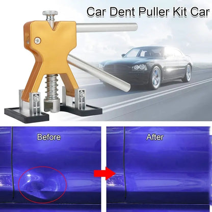 Paintless Dent Repair Kit 21pcs – Car Dent Puller with Hot Glue Gun, Suction Cup Tabs & Bridge Puller, PDR Tool Set for DIY Auto Body Dent Removal, No Paint Damage, Works on Cars, Trucks & Home Use