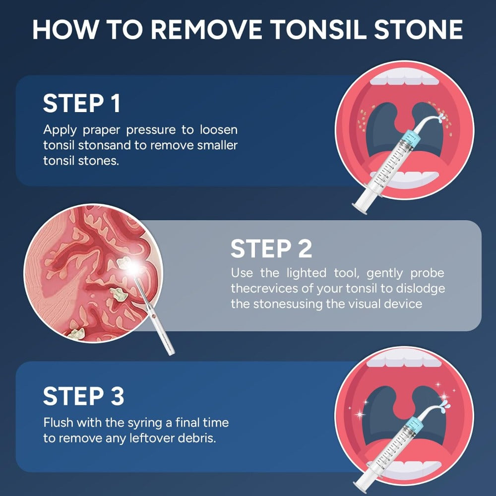 Visual Tonsil Stone Remover with 1080P HD Camera – 6 LED Lights, 5 Stainless Steel Heads, Bad Breath Prevention, iOS & Android Compatible, At-Home Tonsil Care Kit