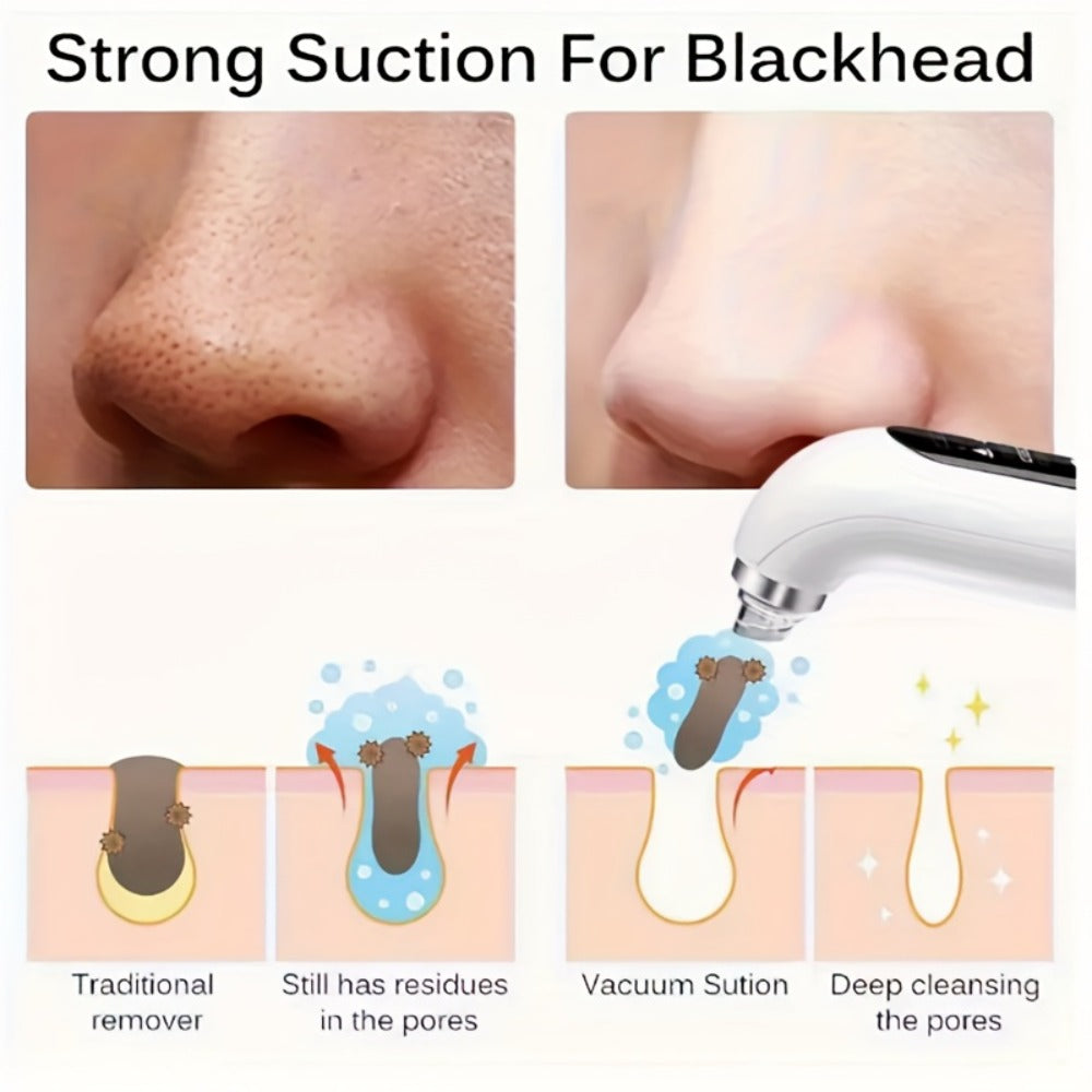 Pore Vacuum Blackhead Remover – 6 Interchangeable Heads & 3 Suction Levels, USB Rechargeable Electric Pore Cleaner, Visible Deep Cleansing Facial Extractor for Men & Women, All Skin Types
