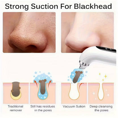 Pore Vacuum Blackhead Remover – 6 Interchangeable Heads & 3 Suction Levels, USB Rechargeable Electric Pore Cleaner, Visible Deep Cleansing Facial Extractor for Men & Women, All Skin Types