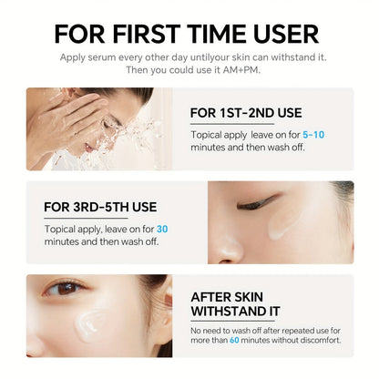 Azelaic Acid Serum 10% for Dark Spots Hyperpigmentation Brightening Uneven Skin Tone Korean Skincare Face Serum Women All Skin Types JING MENG 30ml 45g