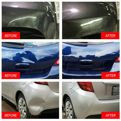 Paintless Dent Repair Kit with Bridge Puller Tabs and Glue Shovel for Car Body Dent Removal Hail Damage Door Ding Repair DIY Auto Body Repair Tool Set