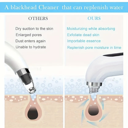 Pore Vacuum Blackhead Remover – 6 Interchangeable Heads & 3 Suction Levels, USB Rechargeable Electric Pore Cleaner, Visible Deep Cleansing Facial Extractor for Men & Women, All Skin Types