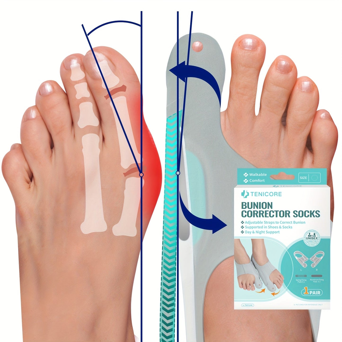 Bunion Corrector Sleeves 2-Pack – 4-Point Fixation Big Toe Separator, Adjustable Day & Night Hammer Toe Straightener for Men & Women