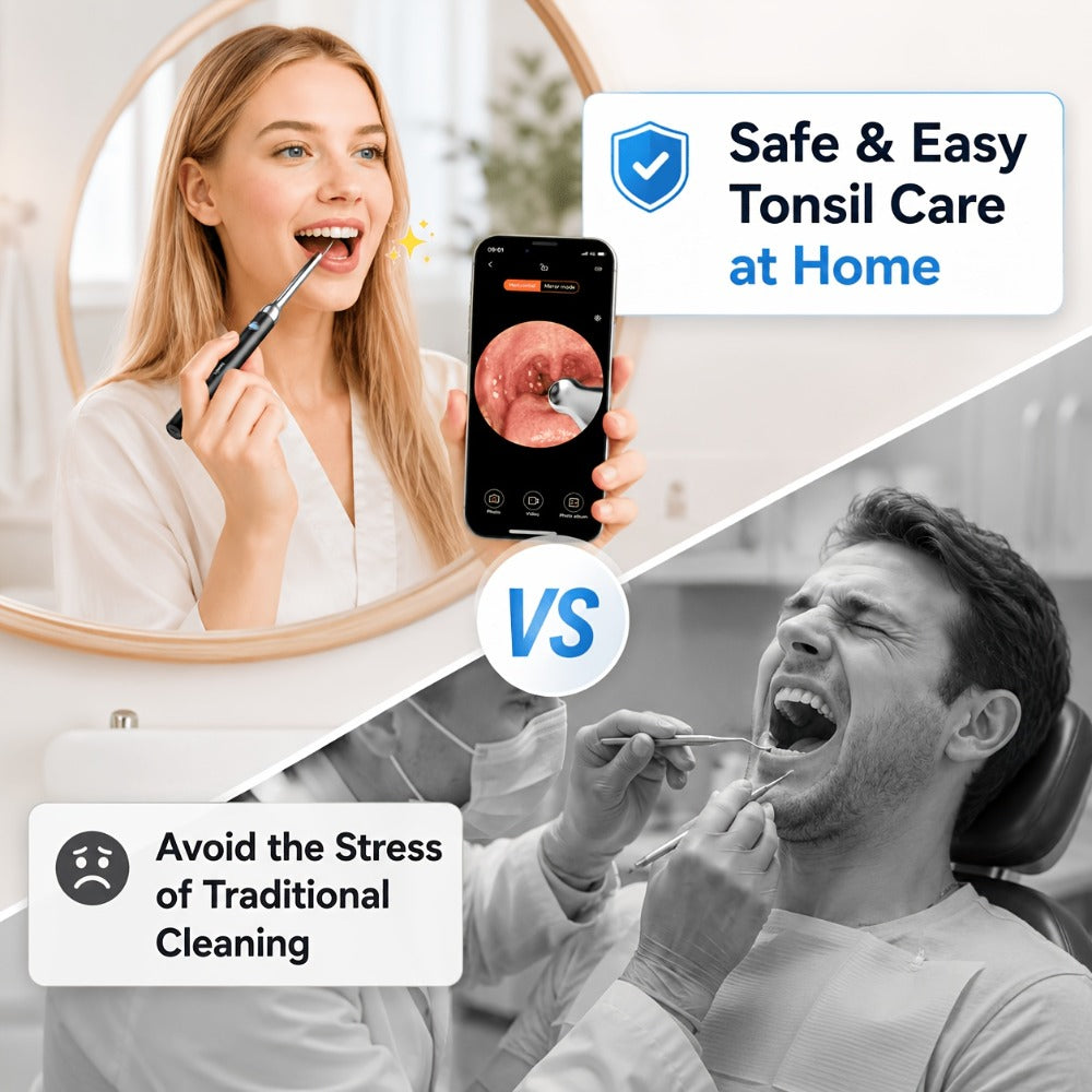 Tonsil Stone Remover with Camera - 1080P HD Visual Tonsil Stone Removal Tool with LED Light, 5-in-1 Stainless Steel Tips, Wi-Fi App Control, USB-C Rechargeable, Compatible with iOS & Android