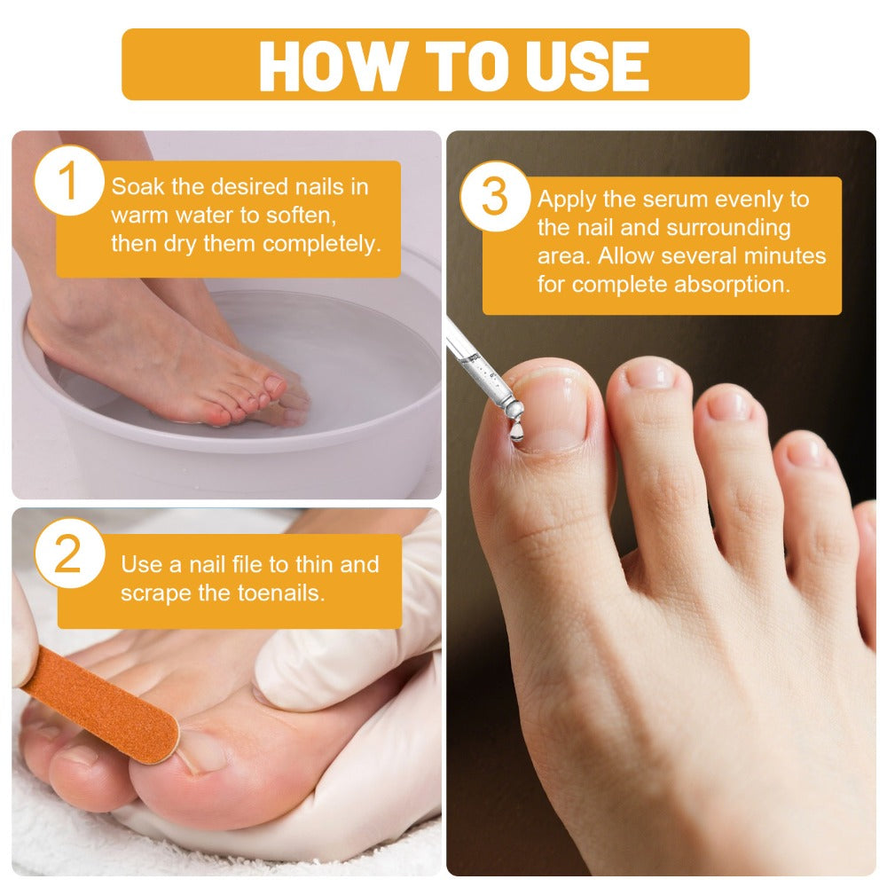 Toenail Repair Solution with Bee Venom Extra Strength Formula for Damaged Discolored Brittle Nails Nail Restoration Serum Visible Results in 7 Days 1.01 fl oz 30ml
