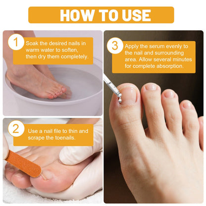 Toenail Repair Solution with Bee Venom Extra Strength Formula for Damaged Discolored Brittle Nails Nail Restoration Serum Visible Results in 7 Days 1.01 fl oz 30ml
