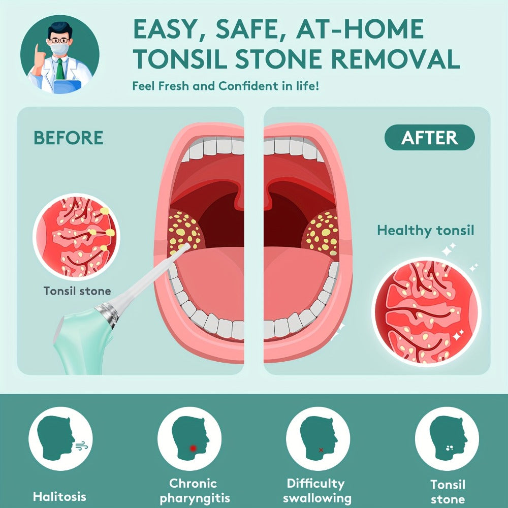 Tonsil Stone Remover Electric Vacuum Kit with LED Light – 3 Suction Modes 5X Magnifying Mirror Oral Irrigator Safe Gentle Tonsillolith Removal Tool for Adults at Home Use Rechargeable Portable