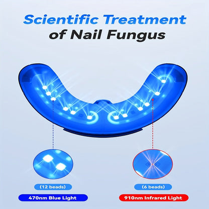 Nail Fungus Laser Treatment Device FDA Cleared - Blue Light 470nm & Infrared 910nm, 3/5/10 Min Timer, Toenail Fingernail Onychomycosis Cleaner Therapy Tool