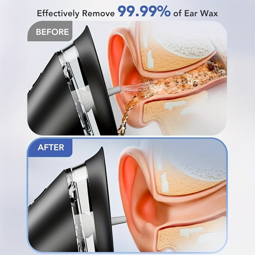 Electric Ear Cleaning System Professional Edition 3-Speed Hydraulic – Visual Waste Tank, Ear Dryer, USB Charging, Dry Dirty Storage, Safe Home Ear Wax Removal Kit Christmas Gift