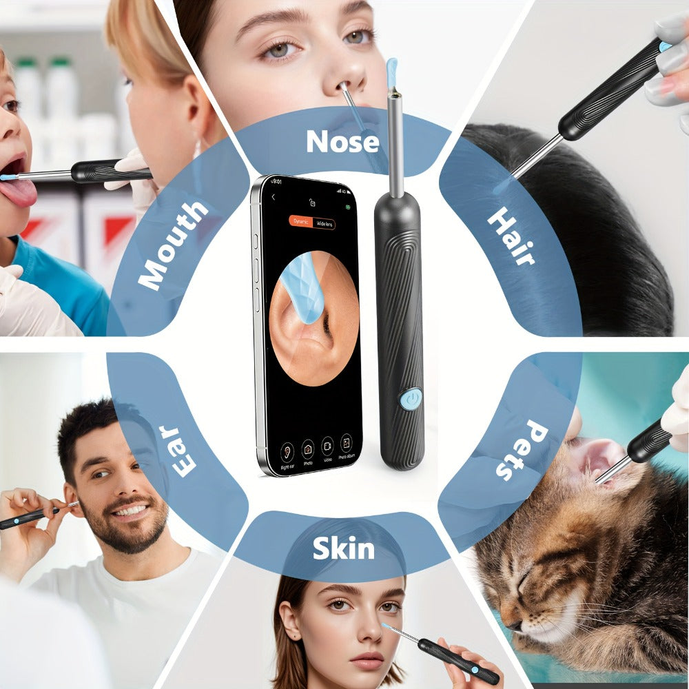 Ear Wax Removal Camera Visual Ear Cleaner 1080P HD – 6 Safety Ear Spoons 7-Piece Kit, USB Charging, Real-Time Smartphone Inspection, Portable Ear Cleaning Tool for Adults Kids, Black and White